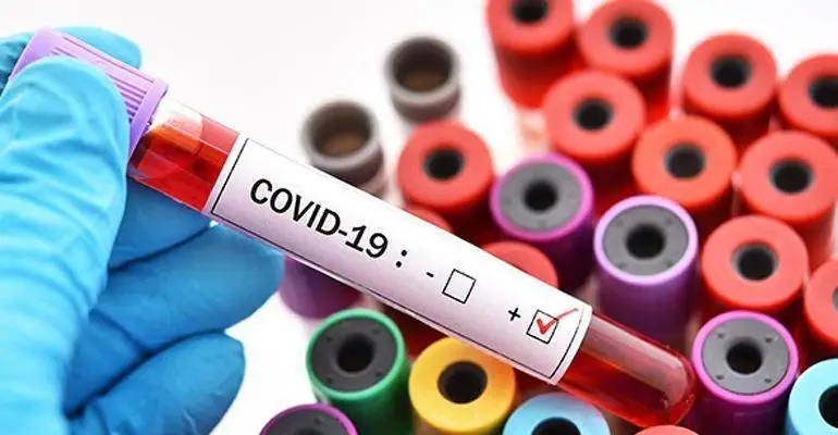 Ecco la mail del ministero degli Esteri a cui segnalare le richieste di certificazioni "virus free"