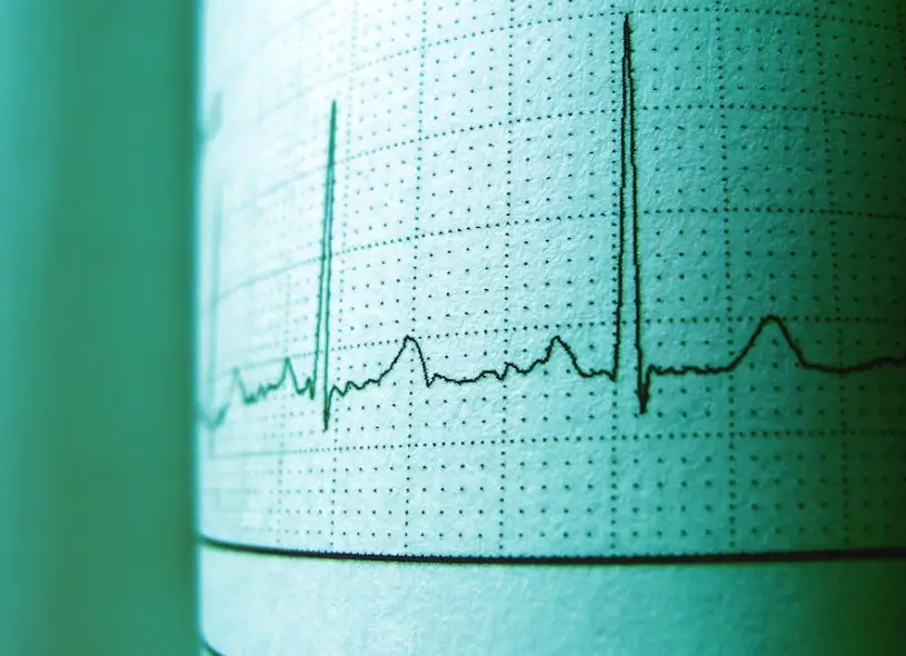 CsC: nel secondo trimestre investimenti ed export decollano